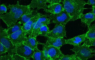 Cancer Research UK Manchester Centre - News